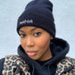Bald•ish Beanie